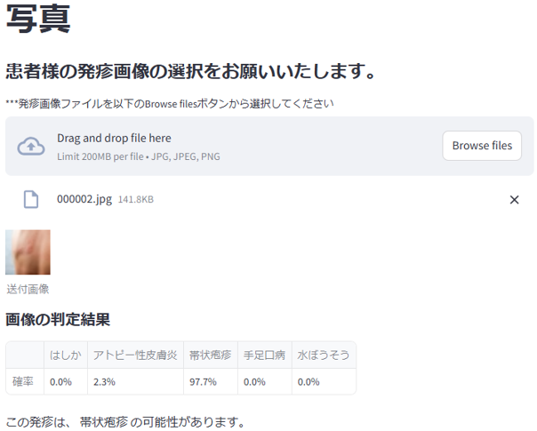Skin-image upload screen